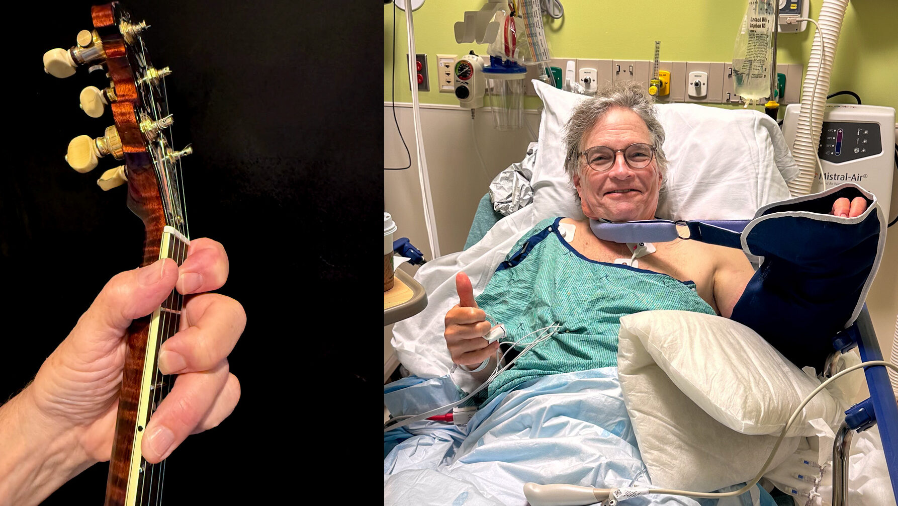 Bill Evans thumb joint replacement surgery