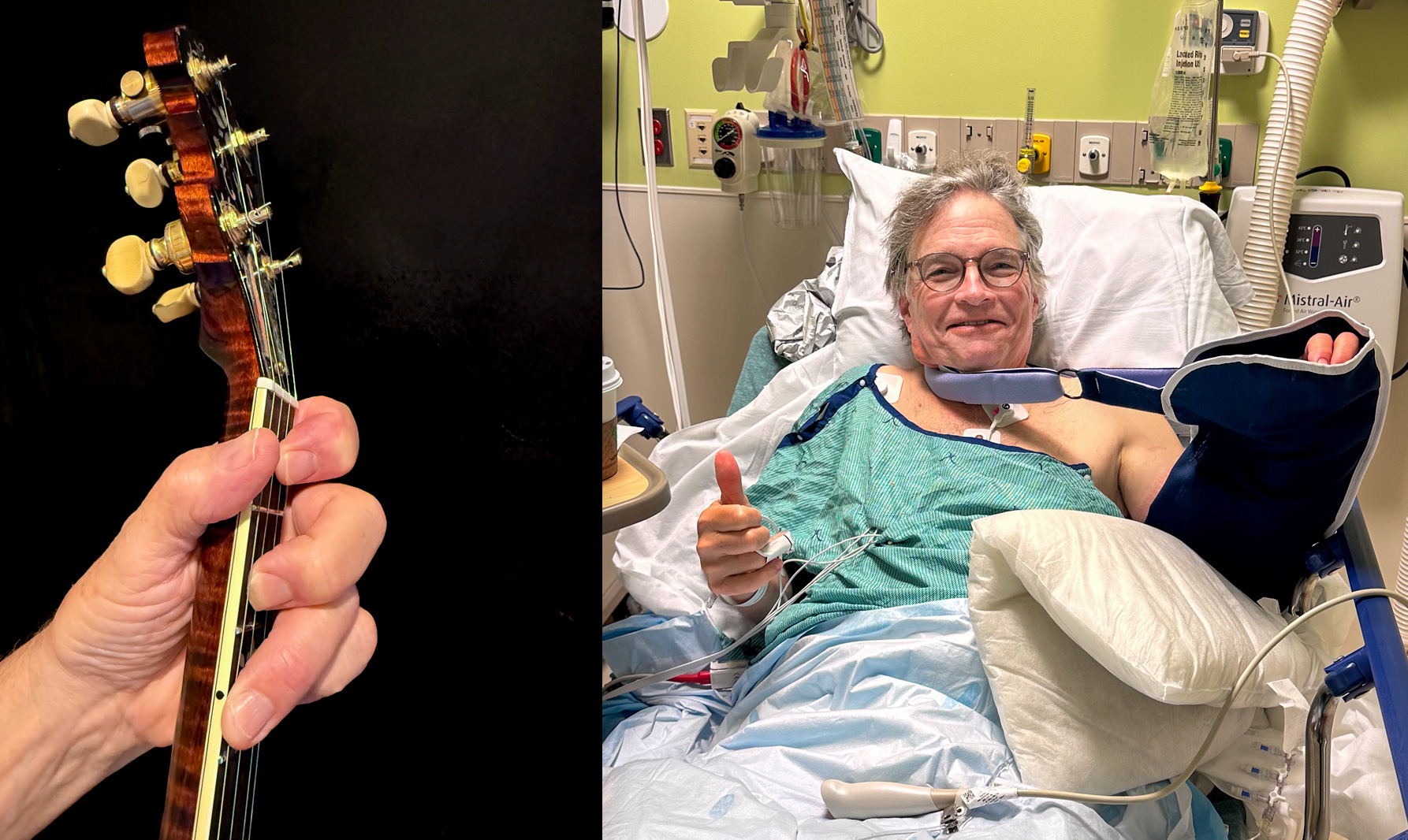 Bill Evans thumb joint replacement surgery