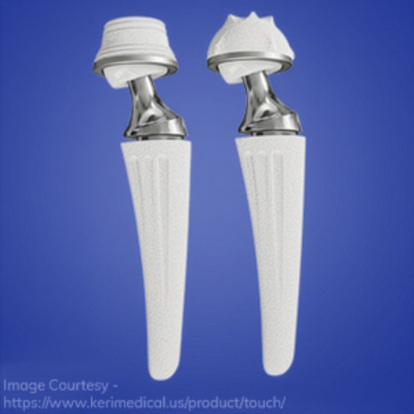 Example of a thumb replacement joint